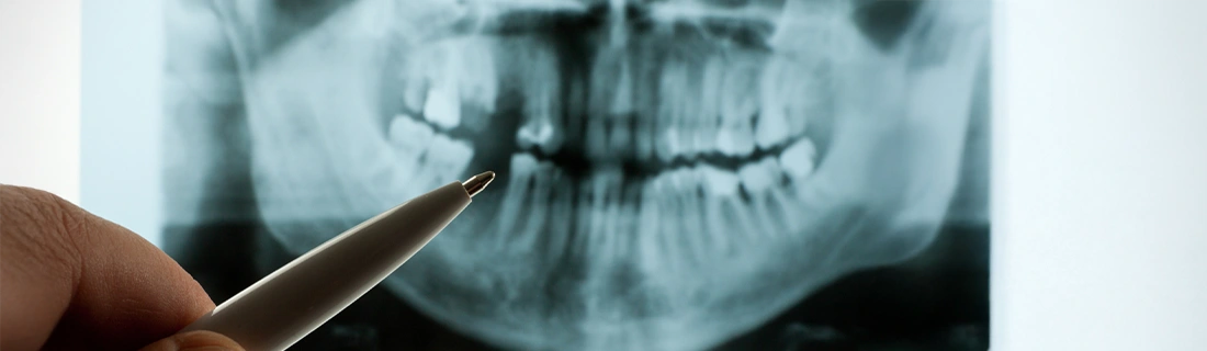 Digital X-Rays In Wall Township NJ